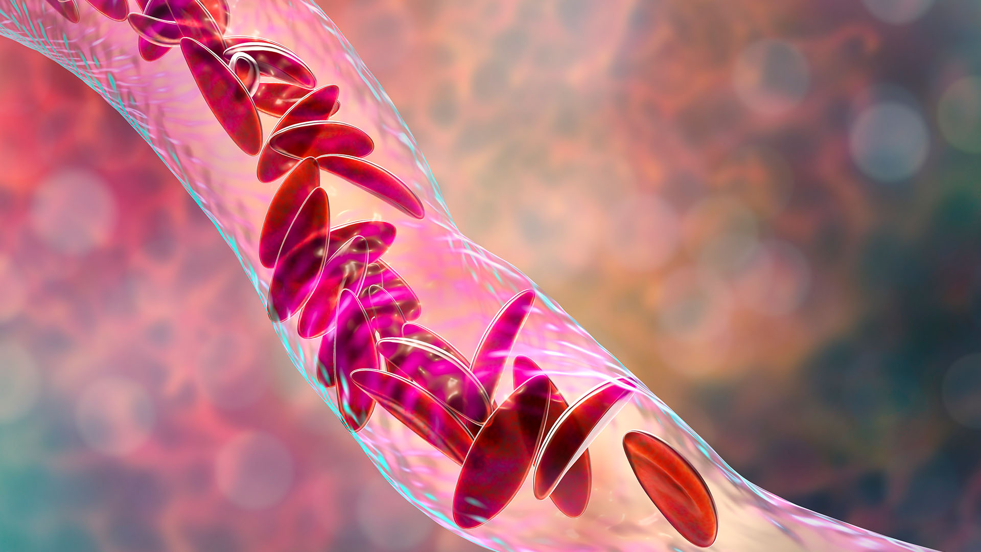prima-terapie-crispr-din-lume-tocmai-a-fost-aprobata.-iata-tot-ce-trebuie-sa-stii