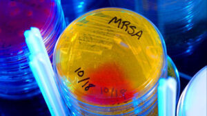 vaccin-pentru-superbacterii?-noua-fotografie-arata-promitatoare-in-primele-teste