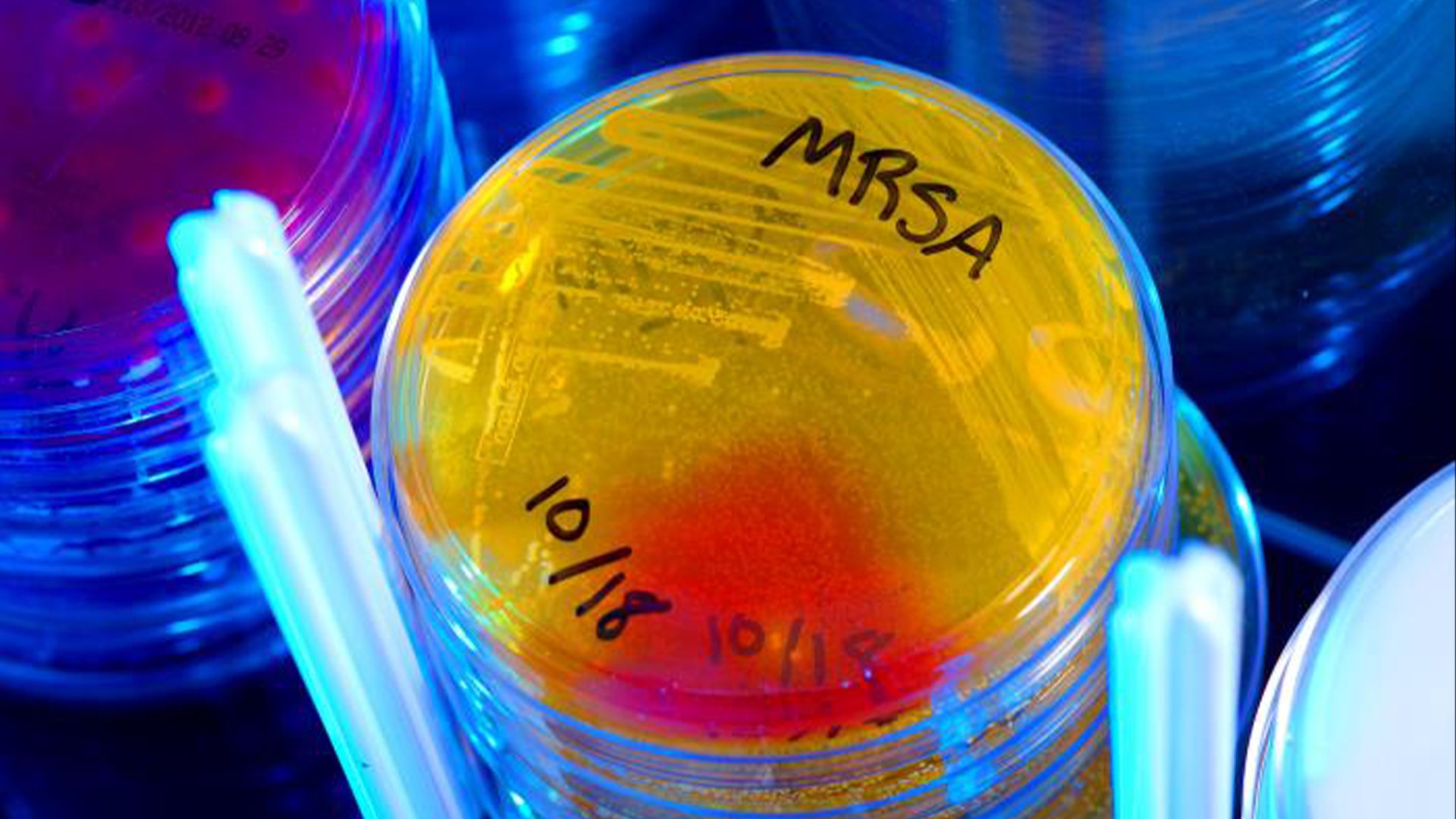 vaccin-pentru-superbacterii?-noua-fotografie-arata-promitatoare-in-primele-teste