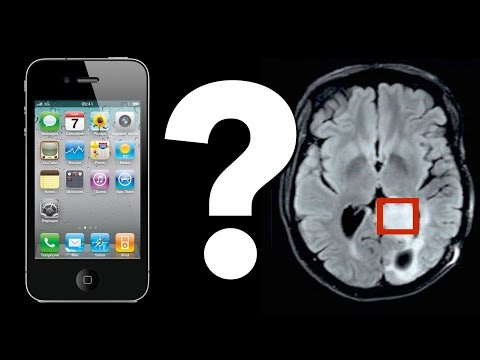 Telefoanele mobile provoacă tumori cerebrale?