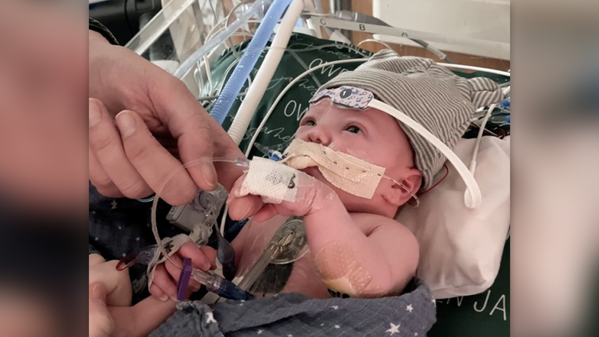 primul-transplant-de-inima-partial-in-crestere-cu-copilul-1-an-mai-tarziu