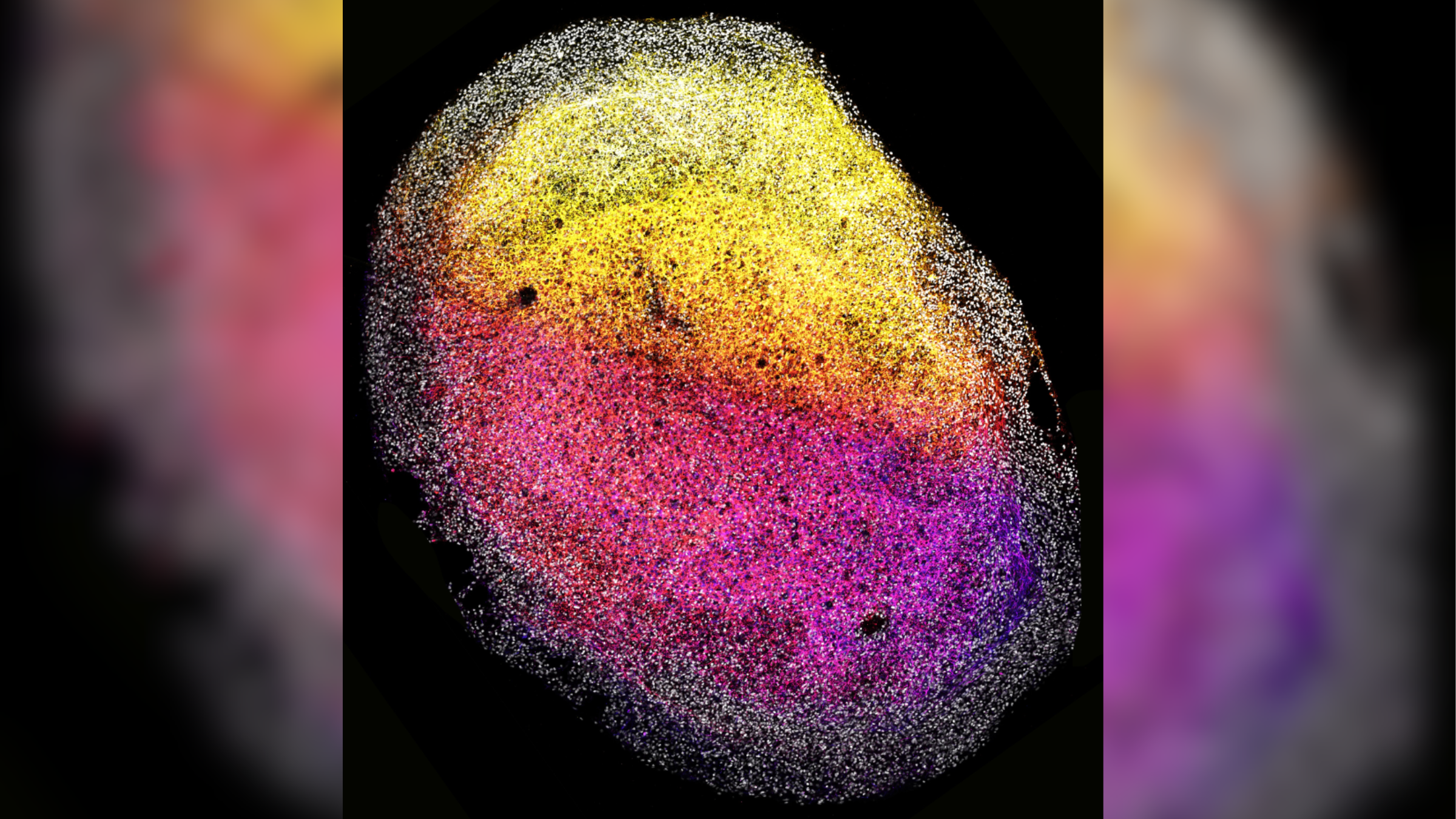 in-primul-rand,-„minicreierul”-crescut-din-tesutul-cerebral-fetal