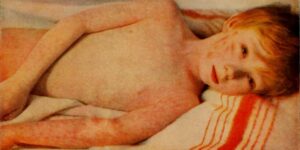 sua-se-apropie-de-punctul-de-varf-al-vaccinarii,-se-confrunta-cu-mii-de-decese-inutile:-fda