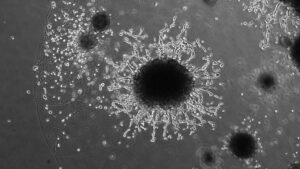 „mini-placentele”-pot-dezvalui-radacinile-tulburarilor-de-sarcina,-cum-ar-fi-preeclampsia