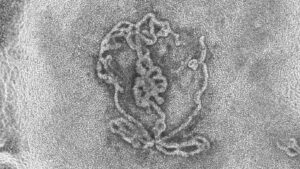 testiculele-mici-crescute-in-laborator-arata-remarcabil-ca-lucrurile-reale-la-microscop