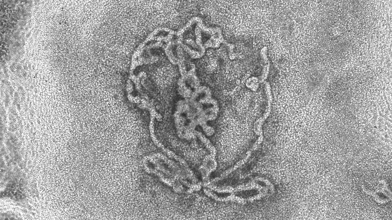 testiculele-mici-crescute-in-laborator-arata-remarcabil-ca-lucrurile-reale-la-microscop