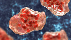 sua-au-avut-deja-mai-multe-cazuri-de-rujeola-in-2024-decat-tot-2023