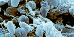 bacteriile-kamikaze-explodeaza-in-explozii-de-toxine-letale