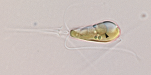 cercetatorii-au-descoperit-un-nou-organel-in-evolutie