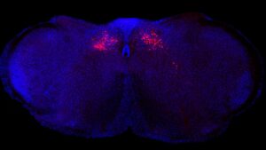 s-a-gasit-un-reglator-principal-al-inflamatiei-–-si-se-afla-in-trunchiul-cerebral