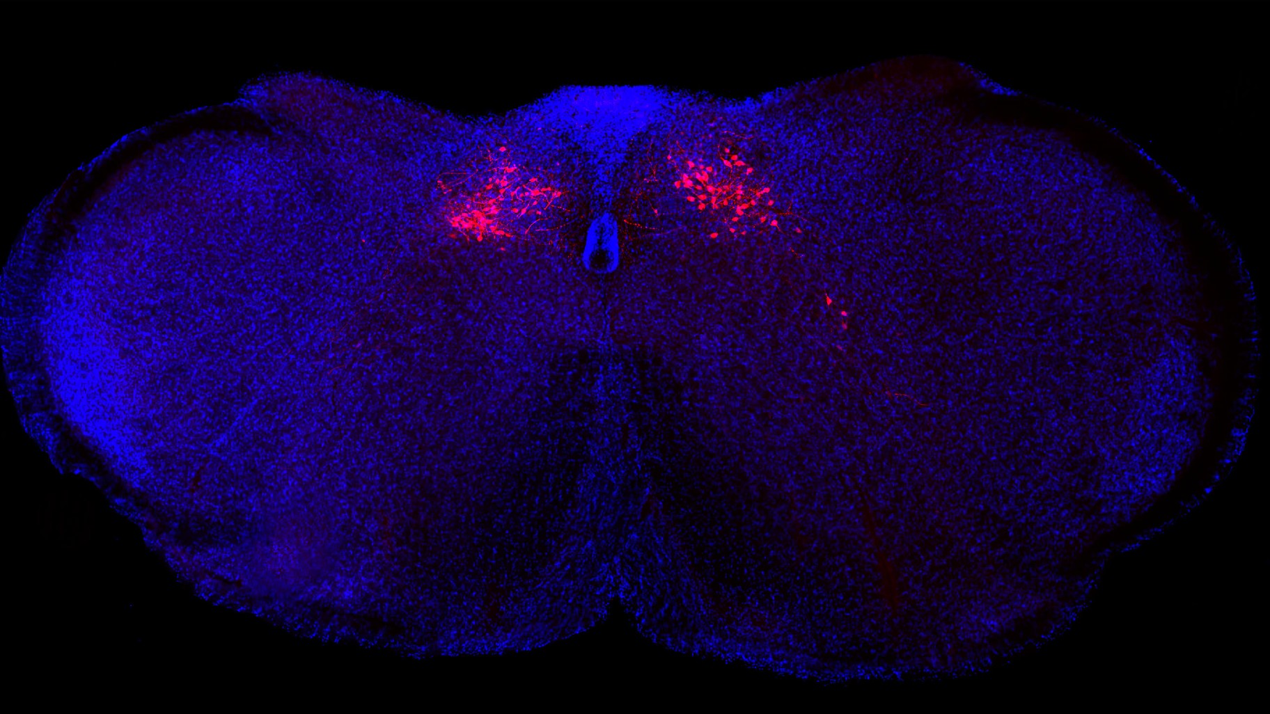 s-a-gasit-un-reglator-principal-al-inflamatiei-–-si-se-afla-in-trunchiul-cerebral
