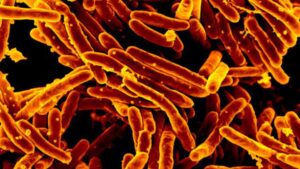 tratamentele-incomplete-cu-celule-stem-in-mexic-au-dus-la-infectii-rezistente-la-medicamente