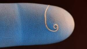 32-de-boli-parazitare-infricosatoare