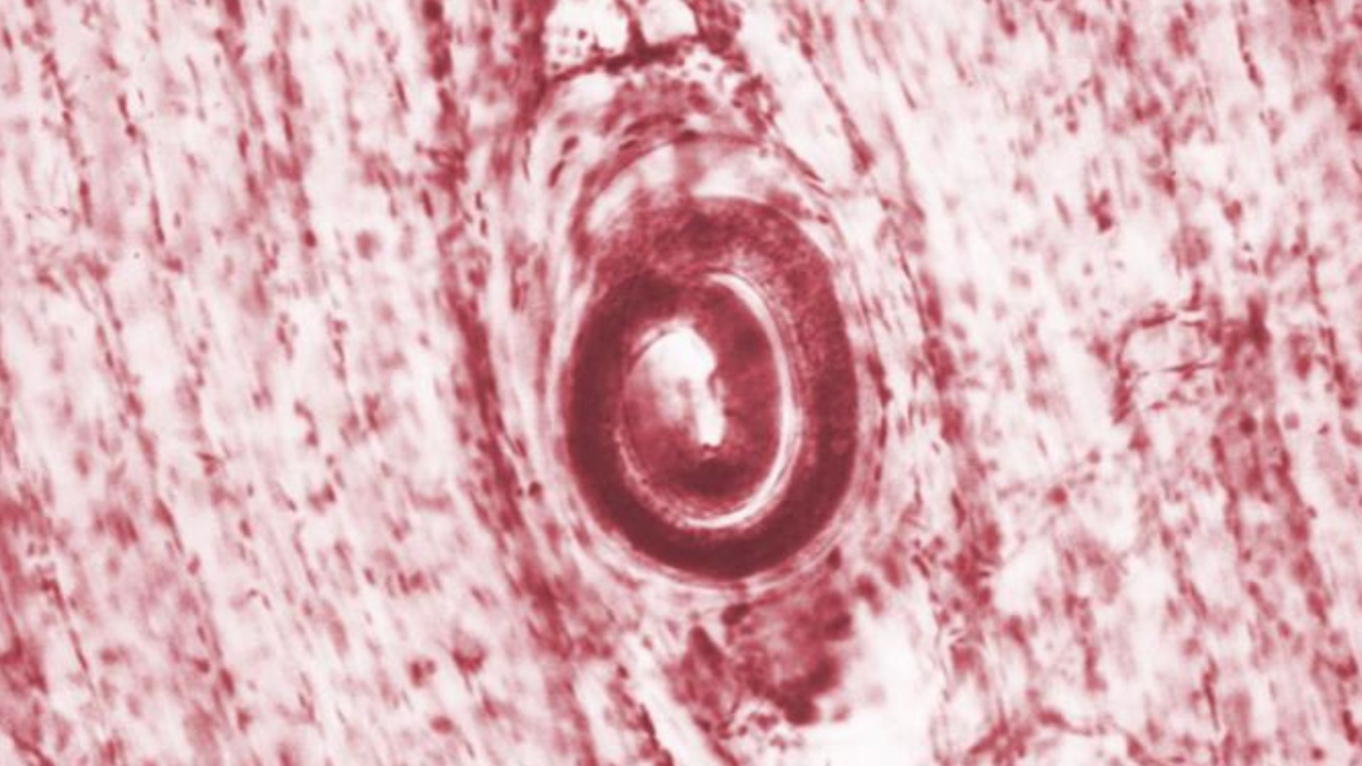 viermii-paraziti-infecteaza-6-dupa-carnea-de-urs-servita-la-reuniunea-de-familie