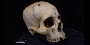craniul-egiptean-antic-prezinta-dovezi-de-cancer,-tratament-chirurgical