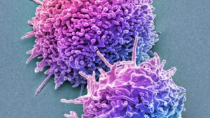 un-nou-test-de-sange-detecteaza-cancerul-ovarian-cu-ani-inaintea-metodelor-conventionale