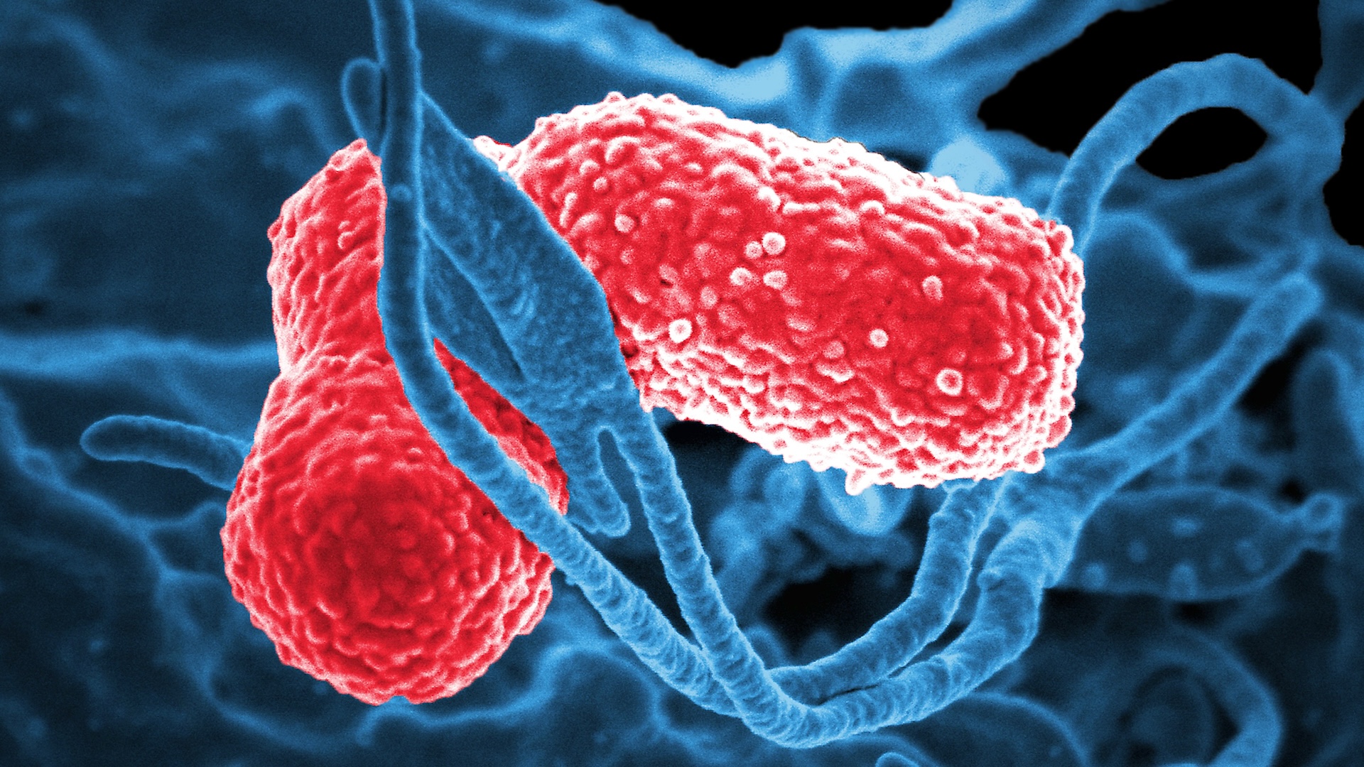 tulpini-periculoase-de-superbacteristici-„hipervirulente”-detectate-in-sua-si-in-alte-15-tari