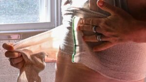 mastectomiile-duble-nu-maresc-supravietuirea-cancerului,-sugereaza-studiul