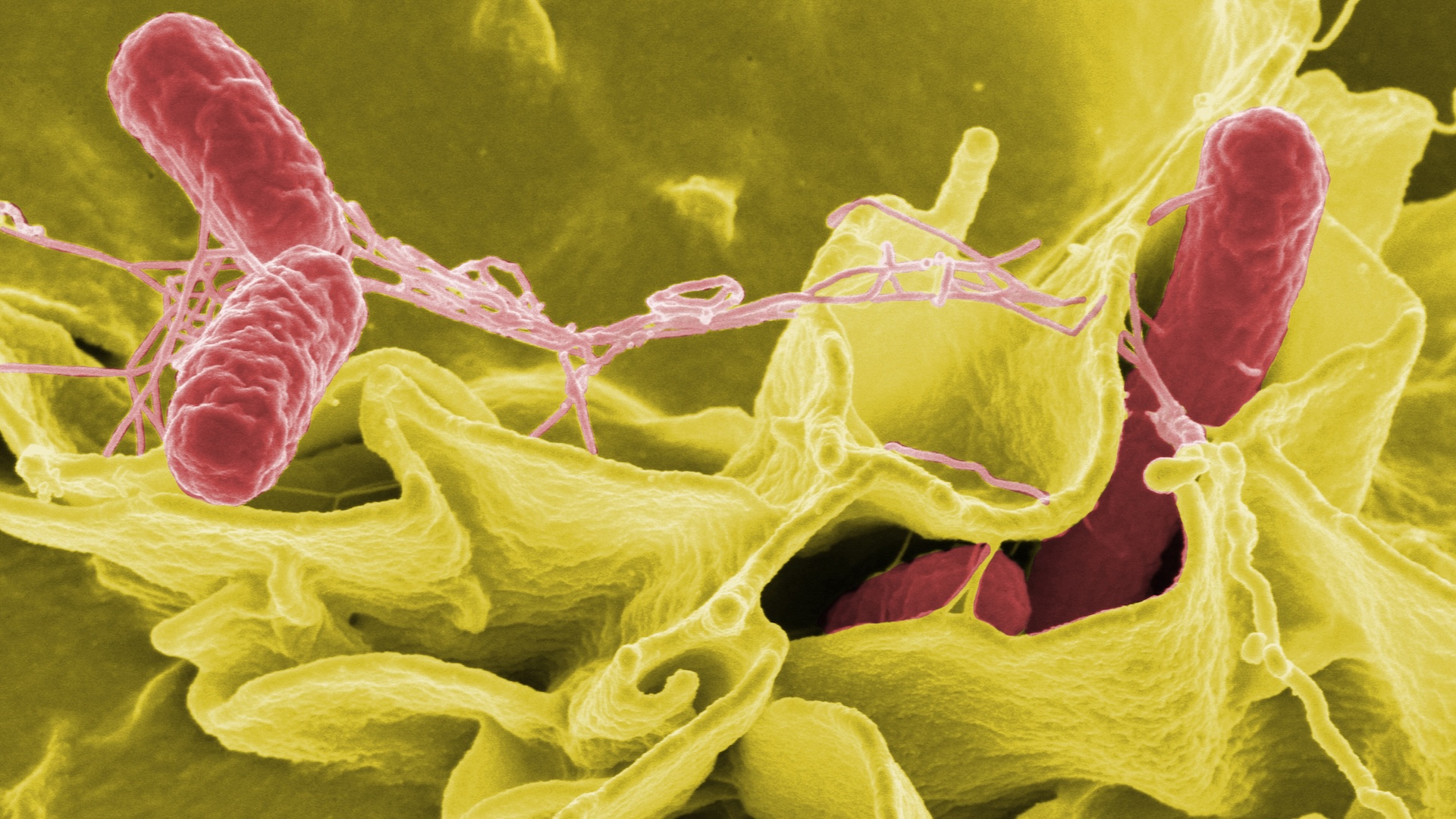 10-dintre-cele-mai-mortale-superbacterii-de-care-oamenii-de-stiinta-sunt-ingrijorati