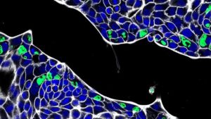 chlamydia-se-poate-ascunde-in-intestin-si-poate-provoca-infectii-repetate