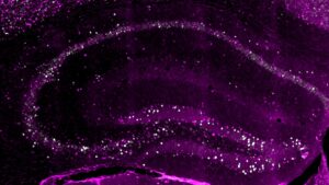 creierul-stocheaza-cel-putin-3-copii-ale-fiecarei-amintiri