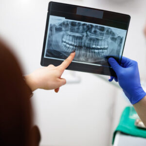 razele-x-dentare-de-rutina-nu-sunt-sustinute-de-dovezi-–-expertii-vor-sa-se-opreasca