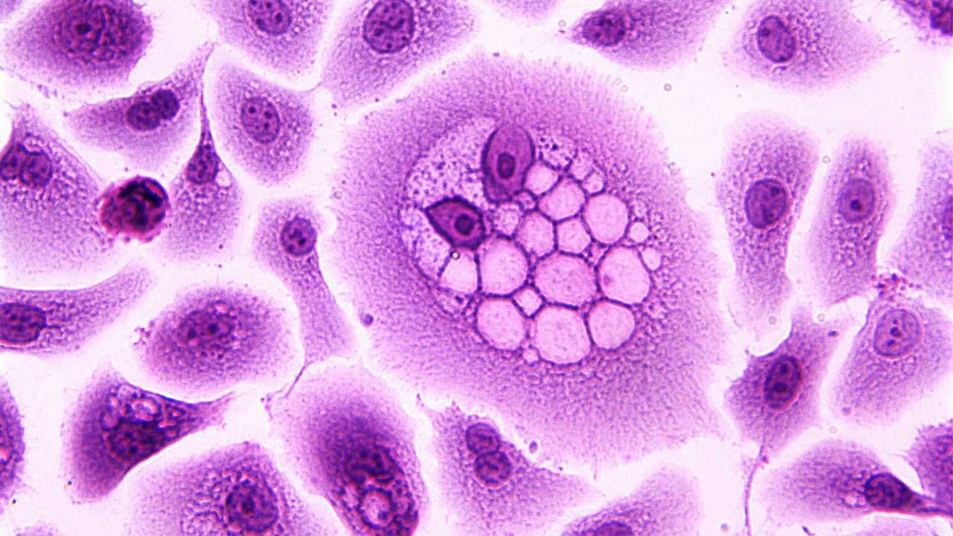 pot-virusii-sa-provoace-cancer?
