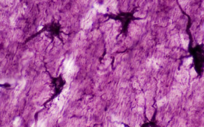 Modificarea celulelor cerebrale non-neurale poate duce la estomparea amintirilor