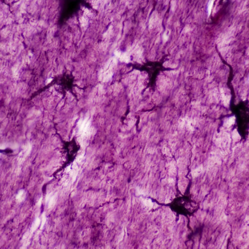 Modificarea celulelor cerebrale non-neurale poate duce la estomparea amintirilor