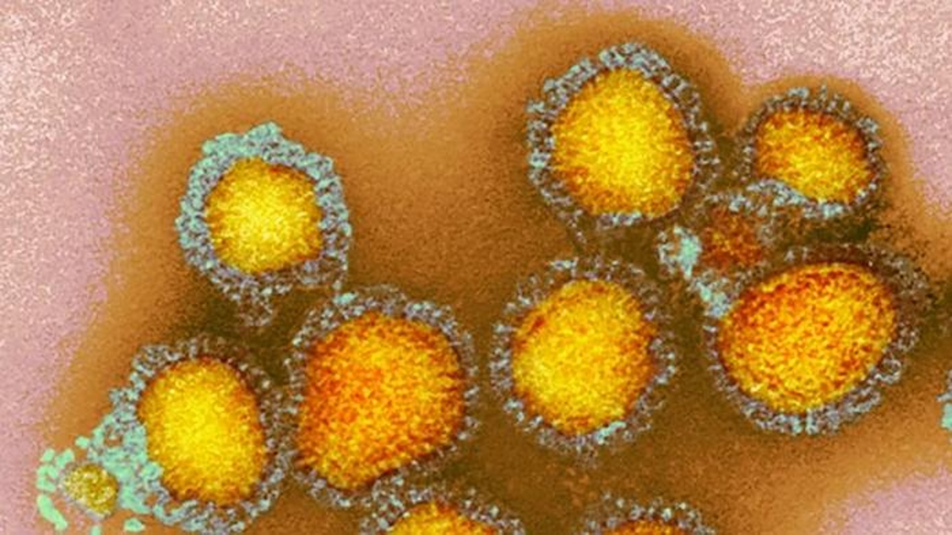 gripa-aviara-loveste-primul-copil-din-sua-–-cdc-spune-ca-sursa-infectiei-nu-este-cunoscuta