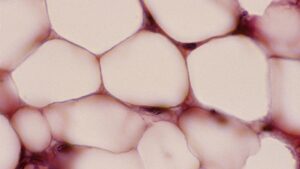 celulele-adipoase-au-o-„memorie”-a-obezitatii,-arata-studiul