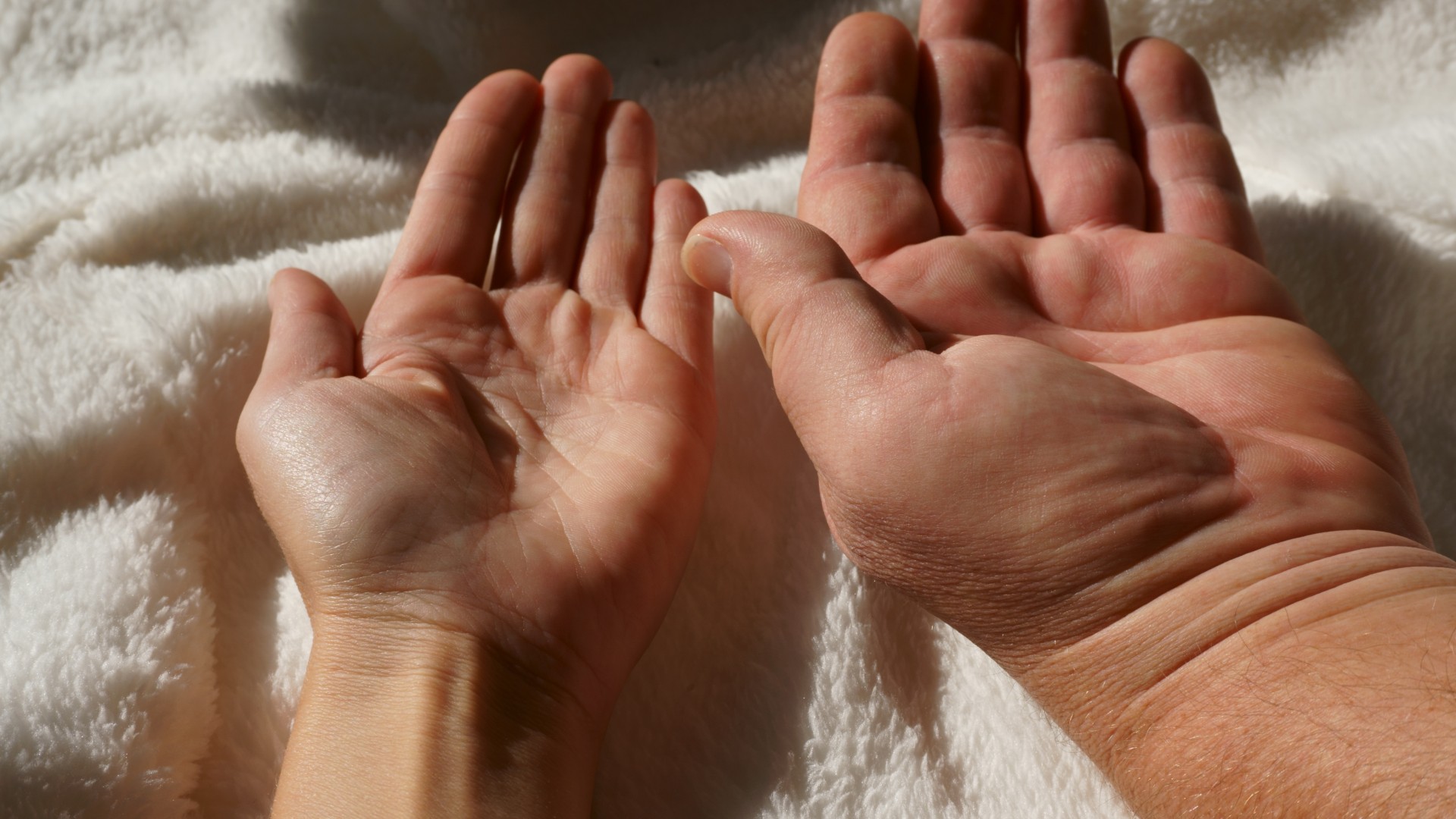 acromegalie:-o-boala-care-determina-adultii-sa-creasca-necontrolat