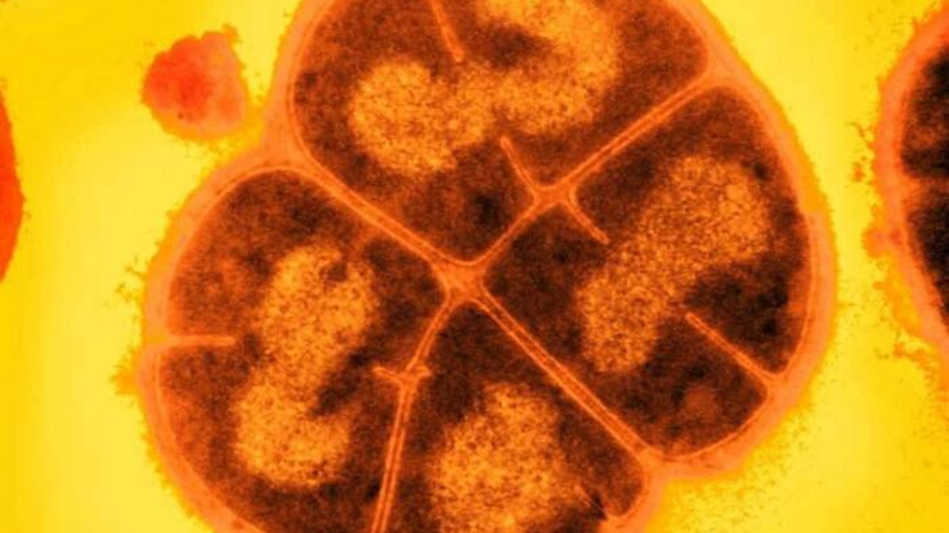 microbul-„extremofil”-rezistent-la-radiatii-numit-„bacteria-conan”-inspira-un-nou-antioxidant