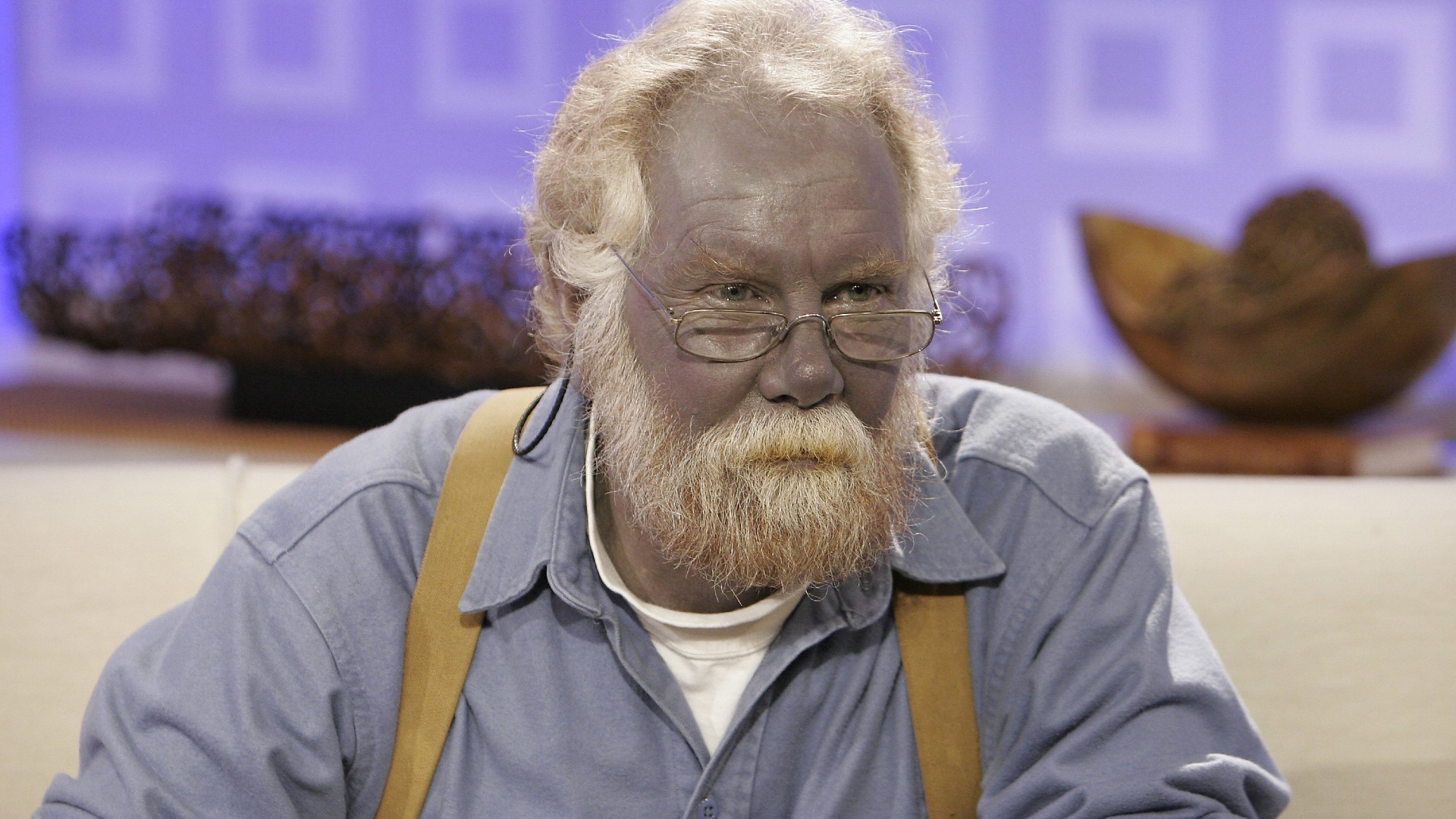 argyria:-boala-rara-care-face-oamenii-albastri
