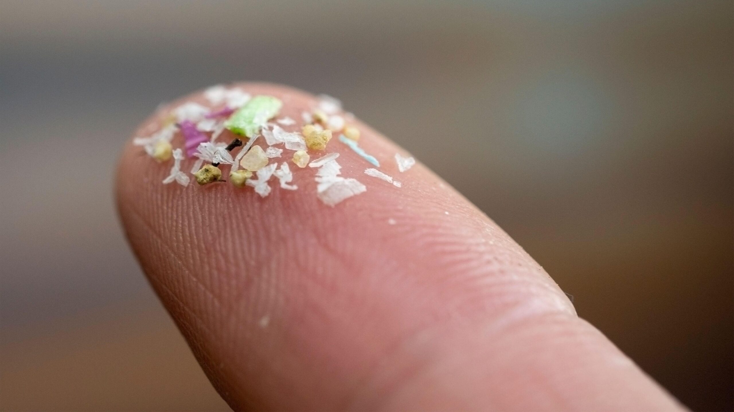„materialele-plastice-sunt-acolo-si-par-sa-se-inrautateasca”:-studiul-viral-al-microplasticilor-in-creierul-uman-arata-o-tendinta-ingrijoratoare,-dar-are-defecte