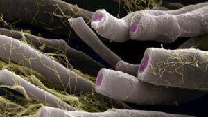 dezechilibrul-bacteriilor-intestinale-legat-de-scleroza-multipla