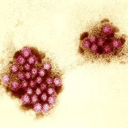 Vaccinul cu norovirus indică în dezamăgirea erorii de stomac explozive în procesul timpuriu