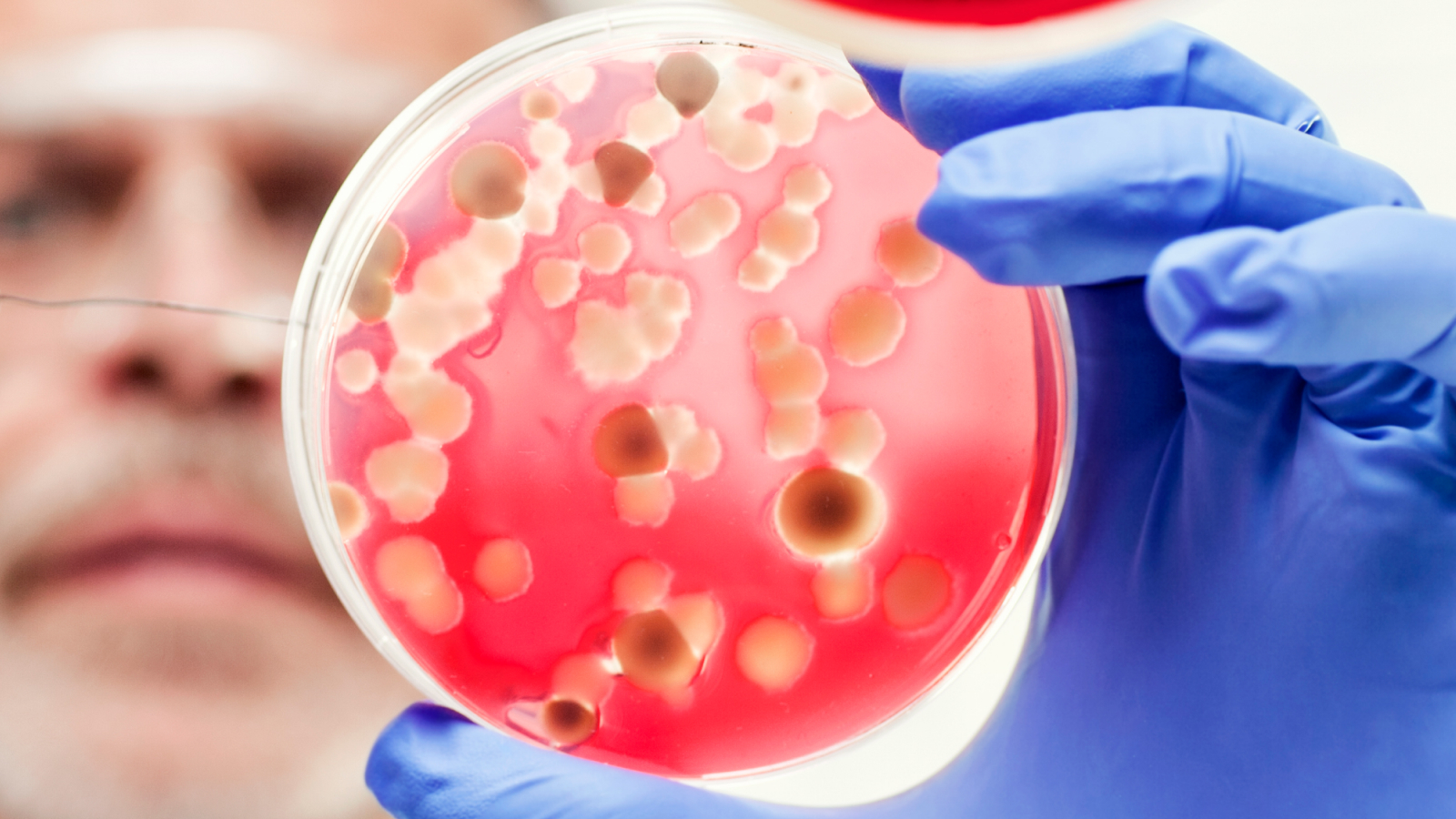 dilema-de-diagnostic:-un-om-de-stiinta-a-prins-ciuma-din-bacterii-considerate-a-fi-„neinfectioase”