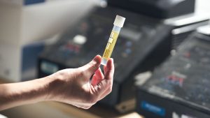 oamenii-de-stiinta-transforma-pee-in-materiale-potrivite-pentru-implanturi-medicale
