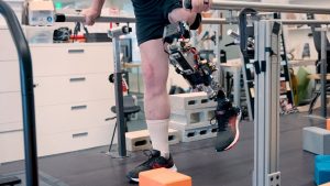 noul-genunchi-bionic-se-conecteaza-direct-cu-muschii-si-osul-pentru-a-se-simti-mai-mult-ca-corpul-utilizatorului