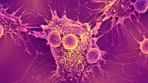 vaccinul-impotriva-cancerului-„universal”-indreptandu-se-catre-studiile-umane-ar-putea-fi-utila-pentru-„toate-formele-de-cancer”