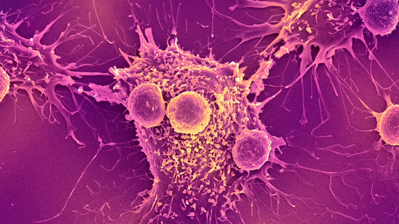 vaccinul-impotriva-cancerului-„universal”-indreptandu-se-catre-studiile-umane-ar-putea-fi-utila-pentru-„toate-formele-de-cancer”