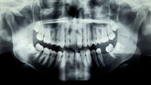dilema-de-diagnostic:-problema-dentara-a-fetei-au-provocat-o-infectie-a-ochilor-care-poate-pune-viata-in-pericol