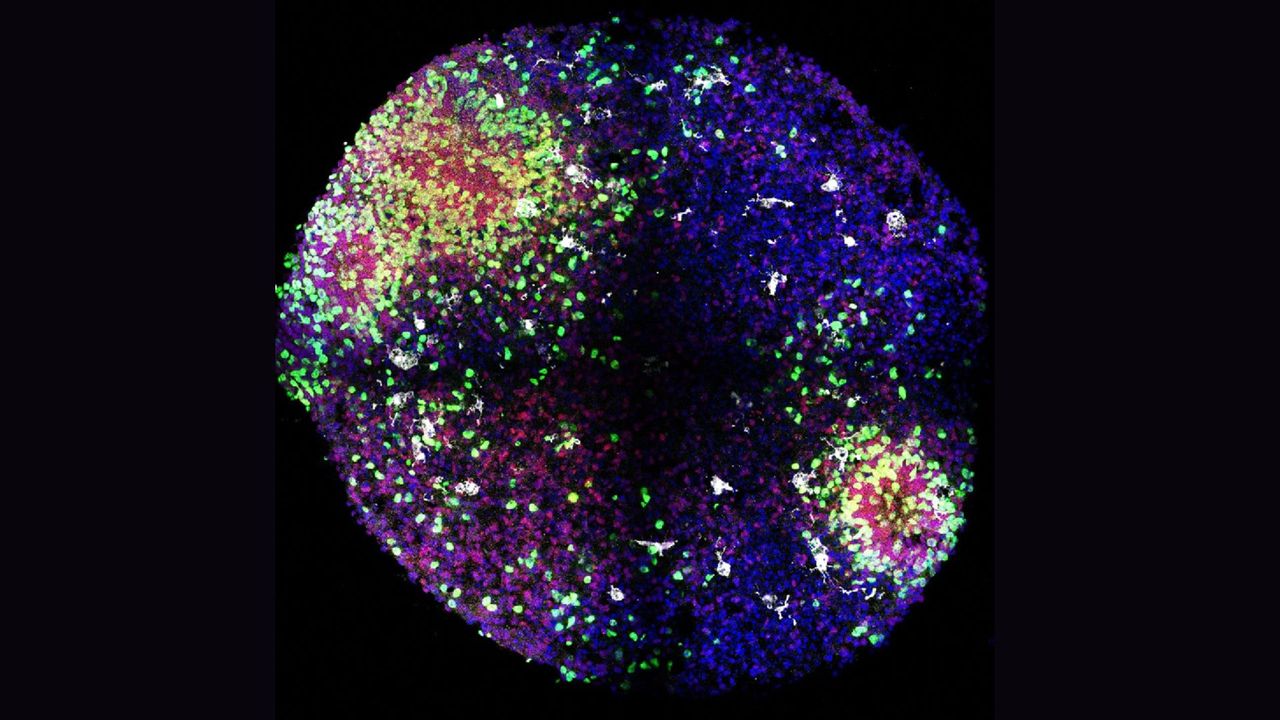 „minibrains”-dezvaluie-secrete-ale-modului-in-care-se-formeaza-celulele-cheie-ale-creierului-in-pantece